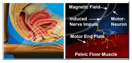 Pelvic Floor Muscle Diagram